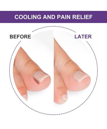 Ingrown Toenail Treatment Kit | Pain Relief Tool for Easy Trimming | Soften Nails & Straighten | Toenail Pain Relief Oil Drops | Natural 50 Patch Treatment - Buy Online on GoSupps.com