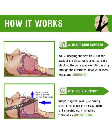 Vivlle Anti-Snoring Chin Strap for Men and Women - Snore-No-More, Slim Non-Slip Design, Adjustable Premium Snore Stopper for Day & Night - Buy Online on GoSupps.com