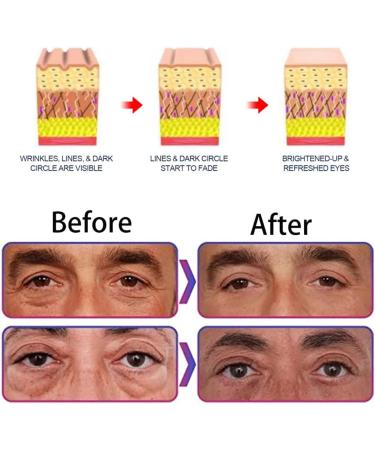  HADAVAKA Men's Eye Cream Awaken Peptide Depuffing Eye Gel Men's Eye Cream Firming Moisturizing Men's Moisturizing Eye Cream Remove Eye Bags Fine Lines Dark Circles (1) - Buy Online on GoSupps.com