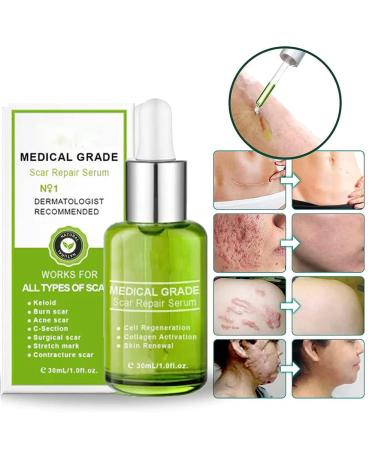 Goopgen Advanced Scar Repair Serum - Medical Grade Scar Remove Cream for All Types of Scars (3PCS) - Buy Online on GoSupps.com