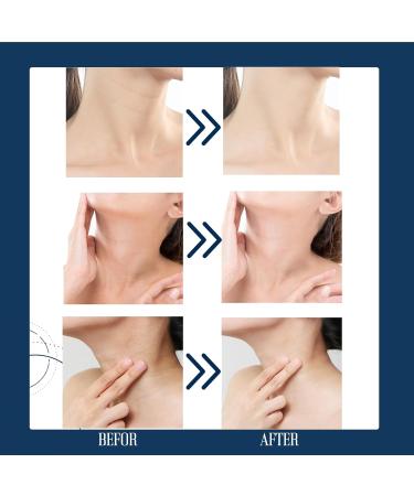 Tighten and Lift Neck Cream - Neck Firming Cream with Retinol and Collagen - Neck Cream Rich in Hyaluronic Acid and Vitamin B5+E - Tightening Lifting Sagging Skin Neck Moisturizer 50ml - Buy Online on GoSupps.com