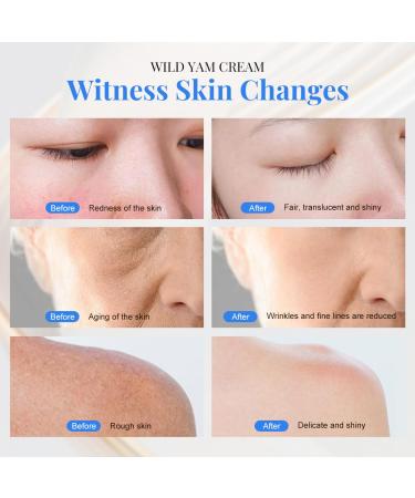 Organic Wild Yam Cream for Hormone Balance | Natural Night Sweats Relief for Men & Women | Perimenopause & Menopause Support - Buy Online on GoSupps.com