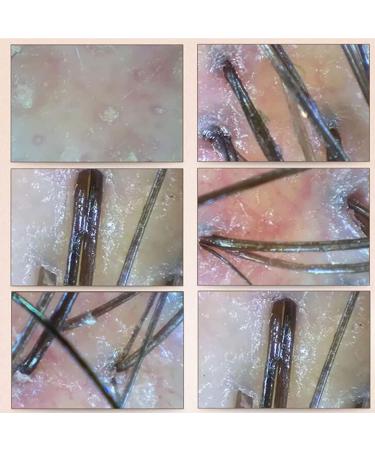 50X/200X Skin Diagnosis Hair Analyzer 7 Inch LCD Screen Digital Skin Diagnosis Scanner System Hair Analyzer Analysis Scanner Skin Health Detection - Buy Online on GoSupps.com