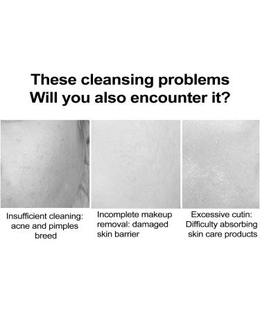 Face Exfoliator Brush | Super Soft Facial Cleansing Brush with Soft Bristles - Face Wash Scrub Exfoliator Brush Manual Handheld Face Skincare for Cleaning Frifer Green - Buy Online on GoSupps.com