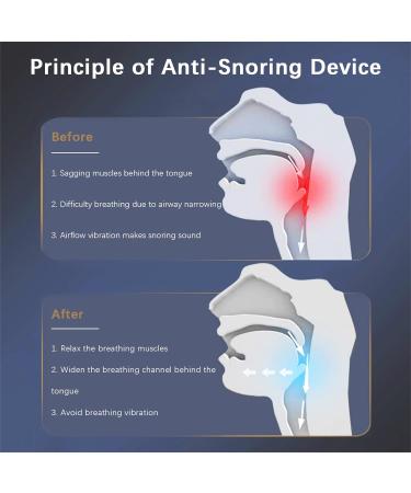 Smart Electric Anti Snoring Stopper - Portable Snoring Solution with Double Eddy Current Fan Design - Buy Online on GoSupps.com