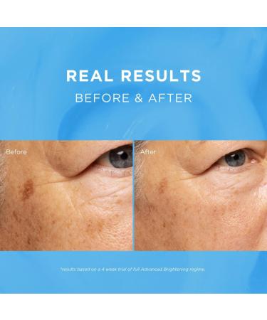 Fade Out Advanced Even Skin Tone Day Cream with SPF25 - Face Cream With Niacinamide and Lactic Acid to Brighten Skin tone in 4 weeks - Buy Online on GoSupps.com