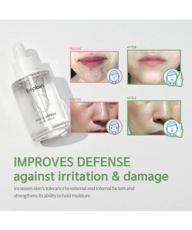 beplain Centella Acne Serum 1.01 fl.oz | Hyaluronic Acid Spot Corrector | Korean Skin Care for Acne Prone Skin - Buy Online on GoSupps.com