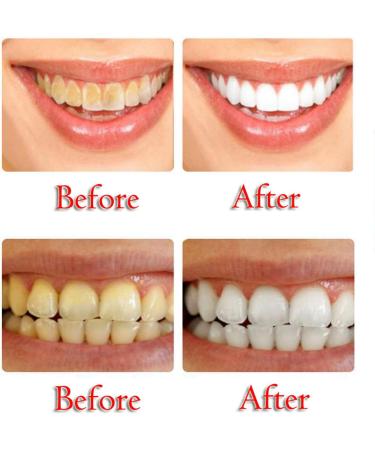 Buy Baking Soda Passion Fruit Whitening Toothpaste | Intensive Stain Removal & Gum Care | Fast International Shipping - Buy Online on GoSupps.com