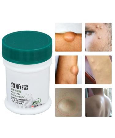 Lipoma Removal Cream 30g - Eliminate Fibroids and Cellulite, Improve Skin Elasticity - Lipomyoma Treatment and Exfoliating Beauty Cream - Buy Online on GoSupps.com