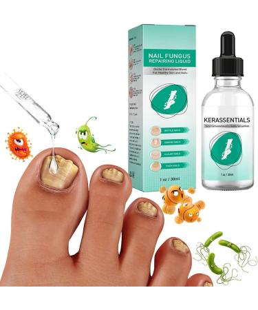Nail Fungus Removal Liquid - Natural Toenail Fungus Oil for Effective Nail Care | BTSEURY - Buy Online on GoSupps.com