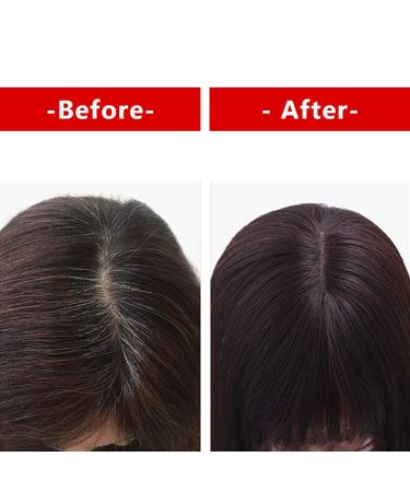 viviaBella 12 Human Hair Topper | Seamless Silk Base Hairpiece for Women | Natural Black - Buy Online on GoSupps.com