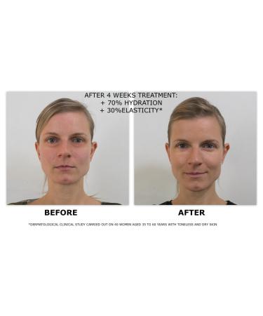 Ultra Nourishing Eyes and Lips Serum - 0.5 oz | Hydrating & Anti-Aging Formula | International Shipping Available - Buy Online on GoSupps.com