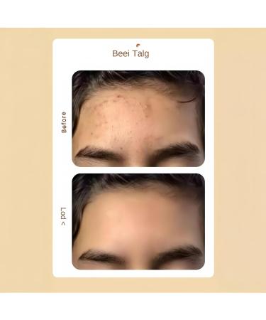  Generisch Moisturizing face cream | 25g gel-cream for sensitive skin morning and night velvety hydration for demanding skin - Buy Online on GoSupps.com