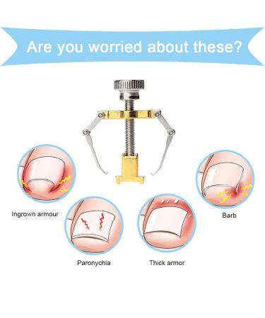 Ingrown Toenail Corrector & Lifter - Professional Toe Clamp for Effective Treatment - Buy Online on GoSupps.com