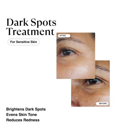 MATKAS Korean Dark Spot Remover Serum for Face & Body with Niacinamide & Oat Extract - Brightening Hyperpigmentation Treatment and Dark Spot Corrector - Buy Online on GoSupps.com