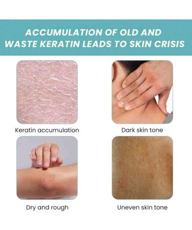 Skin Bath Oil So Soft & Sensual Moisturizes and Hydrates Original Bath Oil for Women Skin Moisturizing Smoothing & Softens Dry Or Rough Skin for Women Men Smooth Skin Bath Oil - Buy Online on GoSupps.com