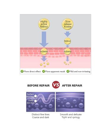 Retinol Anti-Aging Eye Cream 20g/0.7oz for Brightening & Tightening Skin - Men & Women - Buy Online on GoSupps.com