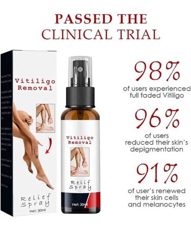 Kolmax Alkyne Psoriasis and Vitiligo Relief Spray - Reduces White Spots on Skin - 3PCS - Buy Online on GoSupps.com