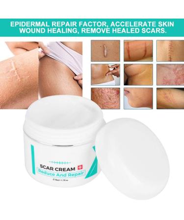 Scar Removal Cream | Stretch Marks Serum | Skin Repair Treatment - Buy Online on GoSupps.com