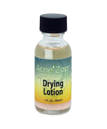 Acne Zap Drying Lotion - Overnight Acne Spot Treatment Dries Out Blemishes  Zits  Whiteheads  Pimples and Blackheads - Extra Strength Natural Solution for Acne Prone Skin - 1 fl oz