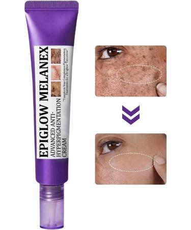  Qfdiwr Anti-Spot Face Cream 20g Night Face Cream Non-Oily Skin Care Products Daily Use Routine Appointments Wedding - Buy Online on GoSupps.com