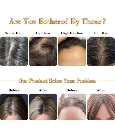 14 Inch Hair Topper for Women with Big Base - Soft Hair Extensions for Thinning Hair - Clip in Hairpiece for Hair Loss - 4C Shade - Buy Online on GoSupps.com