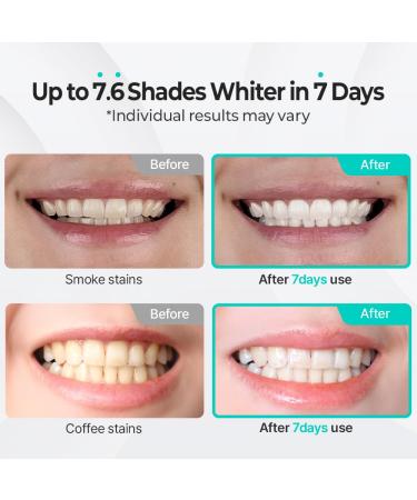 Puredia Whitening Toothpaste 80g Fluoride-Free, Nano Hydroxyapatite & Hydrogen Peroxide, Sensitive Teeth, Enamel Strengthening, Natural Mint Gel Pack of 1 - Buy Online on GoSupps.com