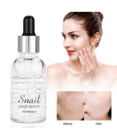 Hydrating Snail Serum - Anti-Aging Face Essence with Collagen | Moisturizing Striae & Wrinkle Cream - 30ml - Buy Online on GoSupps.com