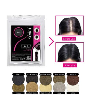 Sevich Hair Fibers - 100g Chestnut Brown Hair Building Fibers | Natural Keratin for Thin Hair - Original Refill - Buy Online on GoSupps.com