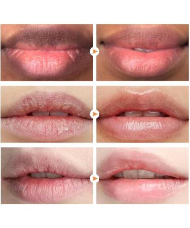 Bubble Lips Bubble Lip Scrub And Lips - Gentle Exfoliating Lips Sugar Lip Polisher And Lips For Cracked Lips And Jingan - Buy Online on GoSupps.com