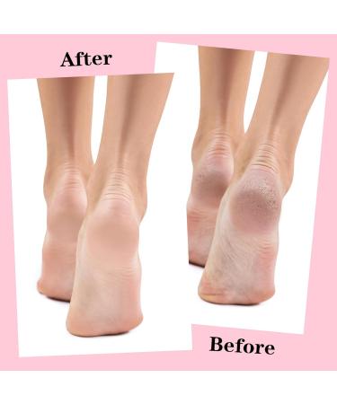 Yolev 2 Pairs Silicone Moisturizing Foot Socks Soft Silicone Socks Anti Slip Gel Spa Socks Women Foot Care Spa Pedicure Silicone Socks for Cracked Heel and Softening Rough Skin Calluses - Buy Online on GoSupps.com