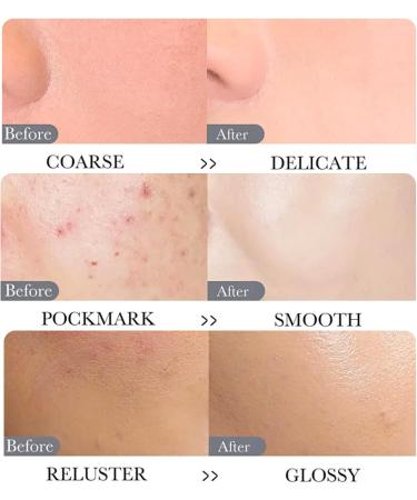 Dead Sea Mud Mask Face Masks Skincare Organic Clay Mask Vegan - Spa Quality Pore Reducer for Acne Blackheads & Oily Skin Deep Cleansing Face Mask Natural Skin Care - Smooth Skin 100ML - Buy Online on GoSupps.com