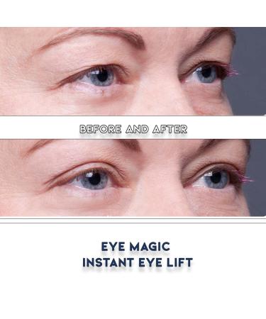 Eye Magic Premium Instant Eyelid Lift (L/XL Kit w/Gel) | Lifts Droopy, Sagging Hooded Eyelids for Youthful Look | Made in America - Buy Online on GoSupps.com