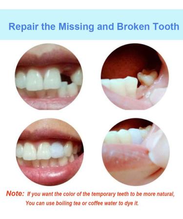 DIY Tooth Filling Thermal Beads: Temporary Moldable False Teeth Kit (2 pack) - Buy Online on GoSupps.com