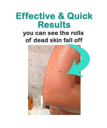 Elbahya Exfoliating Mitt Body Kessa Hammam - 100% Viscose Fiber - Gold Pack - Dead Skin Remover for Keratosis Pilaris - Buy Online on GoSupps.com