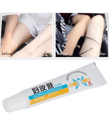 Herbal Cream Skin Itching Allergy Treatment - Portable 15g Skin Care Ointment - Buy Online on GoSupps.com