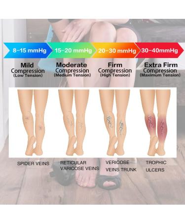 SEXYEYE T.E.D. Anti Embolism Compression Stockings 15-20 mmHg Unisex - Black, Small (1 Pair) - Buy Online on GoSupps.com