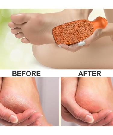 QUBA LINEN Pumice Stone - 2-Sided Terra Cotta Foot Scrubber for Professional Exfoliation | Callus Remover for Feet Hands & Body Care - International Shipping Available - Buy Online on GoSupps.com