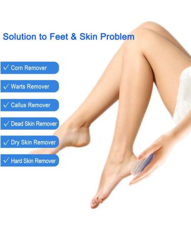 minkissy Sponge Pumice Stone Foot Remove Natural Sponge Pumice Pedicure Supplies Skin so Soft Nail Sponge Pedicure Tool feet Scrubber Dead Skin Multicolor Pedicure so - Buy Online on GoSupps.com