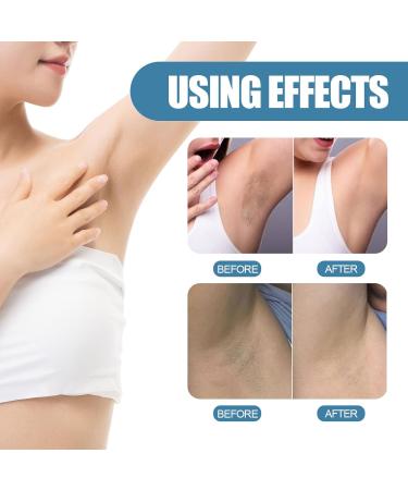 Underarm Whitening Cream Natural Armpit Whitening Cream Effective Body Skin Lightening & Brightening Cream for Knees Elbows Sensitive & Private Areas Whitens Nourishes Restores Skin - Buy Online on GoSupps.com