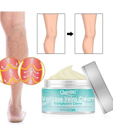 Varicose Veins Cream | Best Treatment for Spider Veins & Inflammation | Gentle Leg Care (50g) - Buy Online on GoSupps.com