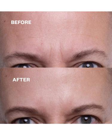 Wrinkles Schminkles Forehead & Under Eye Wrinkle Patch Set - Anti-Aging Silicone Patches - Buy Online on GoSupps.com