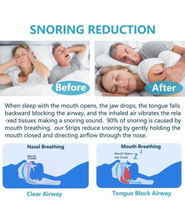 120pcs Sleep Mouth Tape for Snoring, Apnea & Nasal Breathing | Lip Contact Design - Buy Online on GoSupps.com