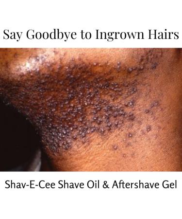 Shav-E-Cee After Shave Gel | Soothing & Hydrating | International Shipping Available - Buy Online on GoSupps.com