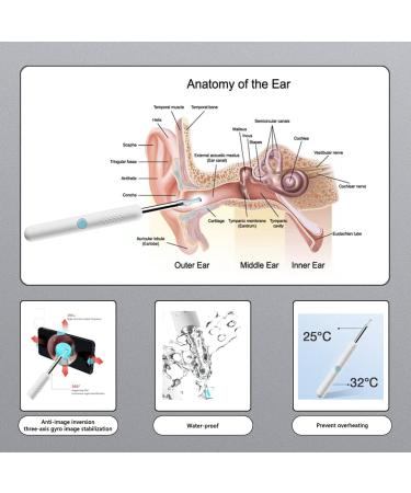 Oxbird(200-300W-PX) HD Ear Scope Otoscope with Light - Ear Wax Camera and Remover Cleaning Kit - Buy Online on GoSupps.com