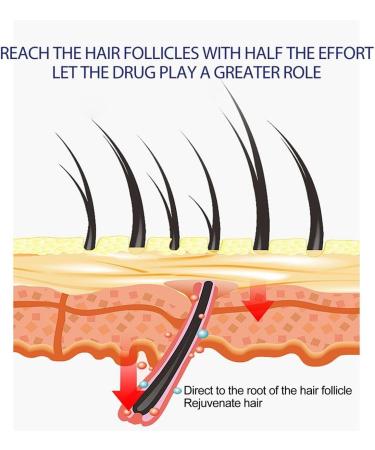 Mousse pour Les Cheveux pais des Hommes Hydrate Les follicules pileux du Cuir chevelu des Hommes Cheveux pais - Buy Online on GoSupps.com