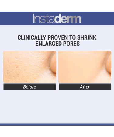 Exfoliating Gel Cleanser - Deep Cleanse & Anti-Aging Solution for Face & Body | Clear Pores Fade Age Spots & Reduce Acne - Buy Online on GoSupps.com