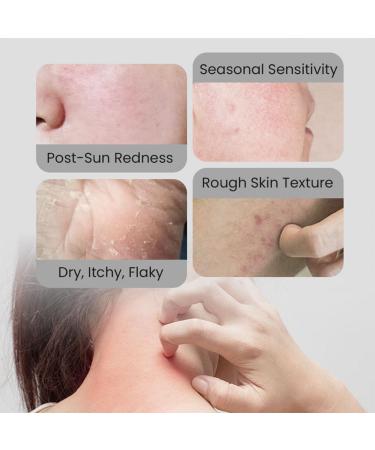 Deep Moisturization Non-Greasy Body Lotion Body Lotion for Dry Skin Fast-Absorbing and Non-Greasy Lightweight Moisturizes for All Skin Types (2PCS) - Buy Online on GoSupps.com