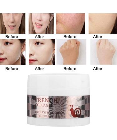 Sonew Snail Collagen Cream 20G/0.7Oz Whitening Cream Moisturizing Hydrating Brightening Skin Care Cream Facial Moisturiser for Skin Care - Buy Online on GoSupps.com