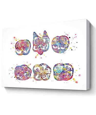 MBARE Watercolor Inspirational Wall Art Surfaces Molar Teeth Watercolor Print Human Tooth Art Dental Clinic Decor Art Dentistry Office Dentist Gift Orthodontist -8"X12" Canvas Print With Frame red-8 8"L x 12"W